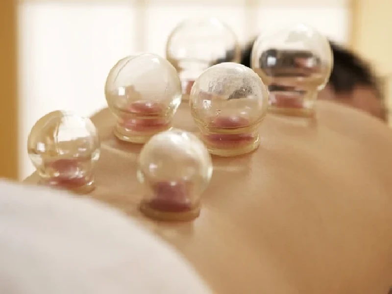 cupping therapy massage